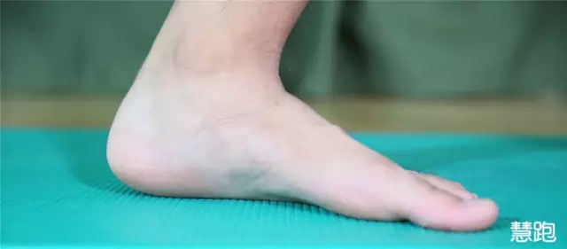 跑完步小腿拉伸错误,可能会引发扁平足